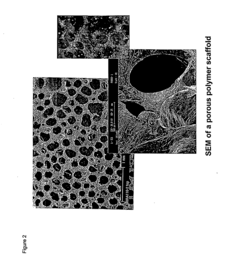 Biodegradable polyurethane/urea compositions