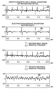 Biomagnetic field measuring apparatus