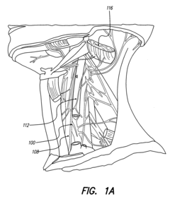 Treatment of movement disorders with drug therapy