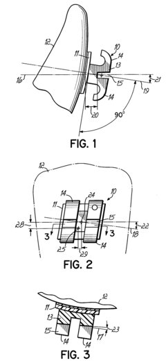 Providing custom orthodontic treatment with appliance components from inventory