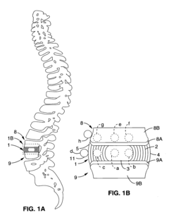 System and method providing directional ultrasound therapy to skeletal joints