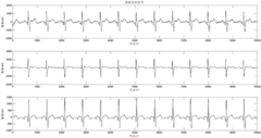 P-wave extracting method based on orthogonal projection and independent component analysis