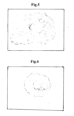 Scaffold for tissue engineering, artificial blood vessel, cuff, and biological implant covering member