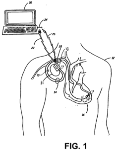 Implantable medical device with MRI and gradient field induced capture detection methods