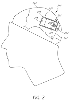Auto adjusting system for brain tissue stimulator