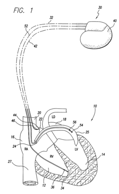 Implantable medical device having atrial tachyarrhythmia prevention therapy
