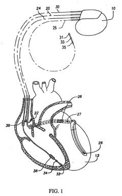 Methods and systems for analyzing t-wave alternants
