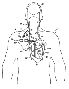 Selective nerve fiber stimulation